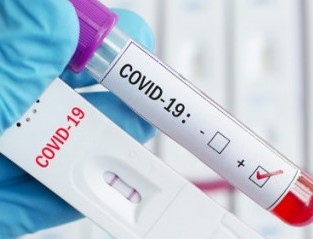 253 са новите случаи на коронавирус у нас при направени